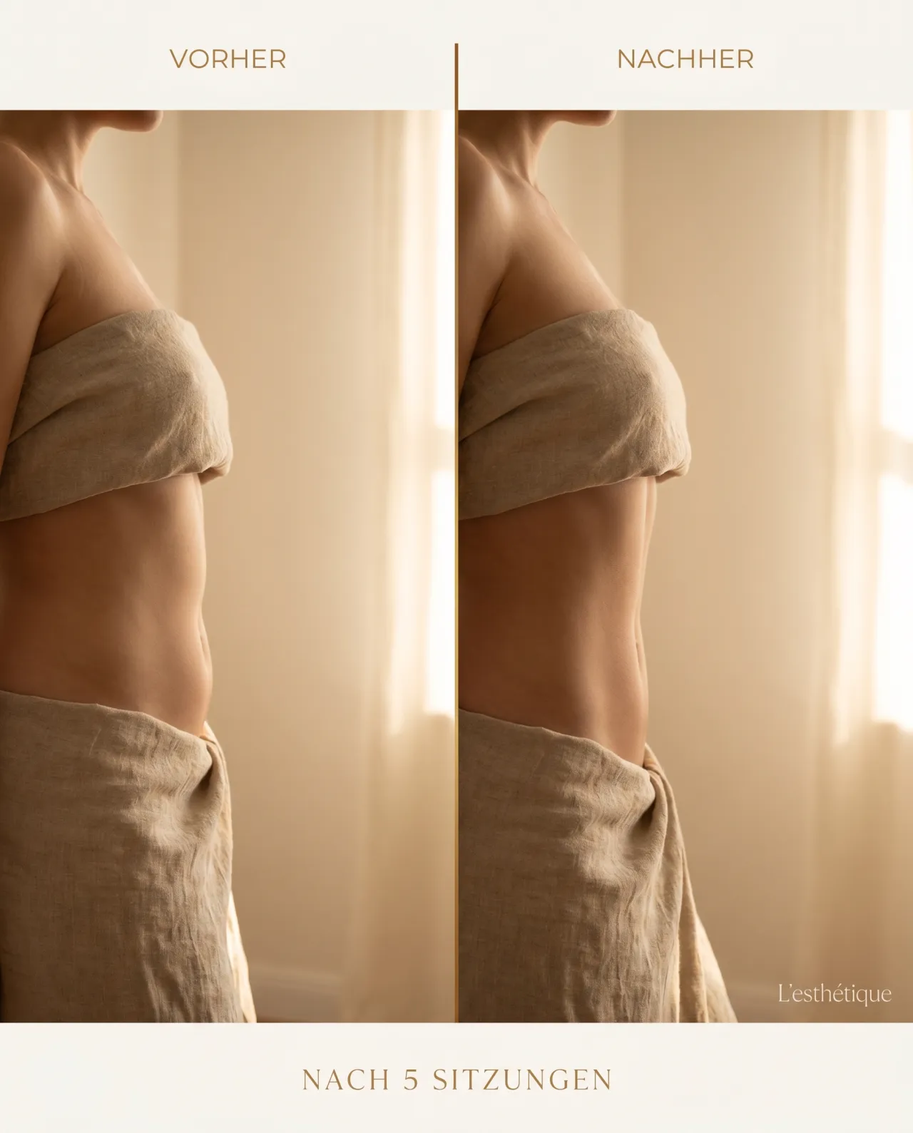 Vorher-Nachher: Brasilianische Lymphdrainage, 5er Kur